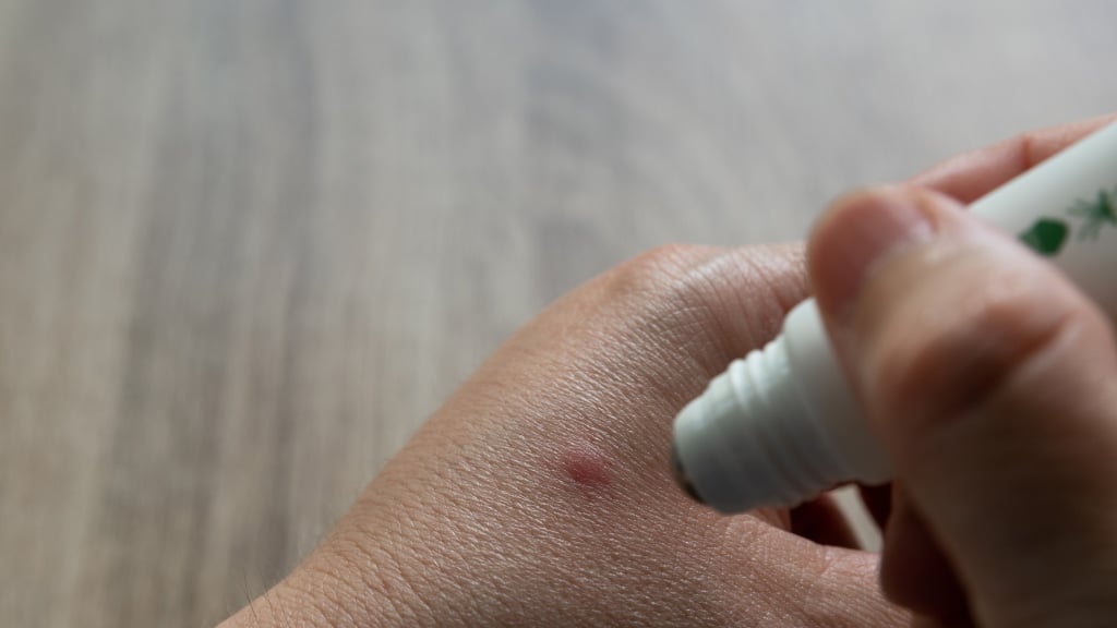 Spider Bite