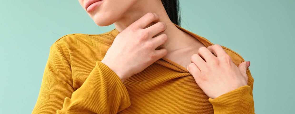 Flea Bites
