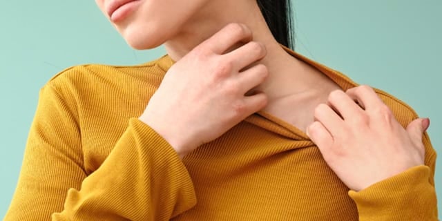 Flea Bites