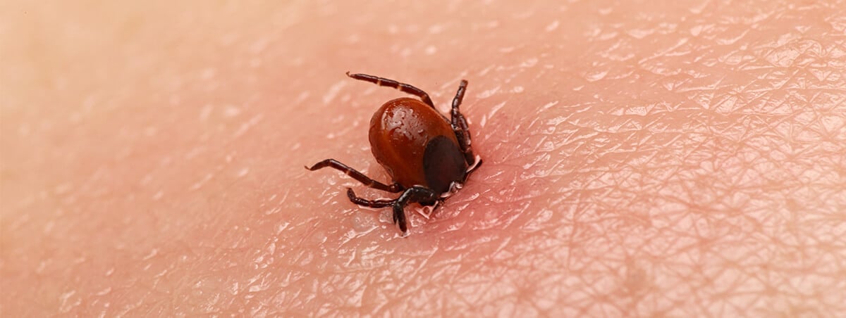 Why Are We Afraid Of Bugs