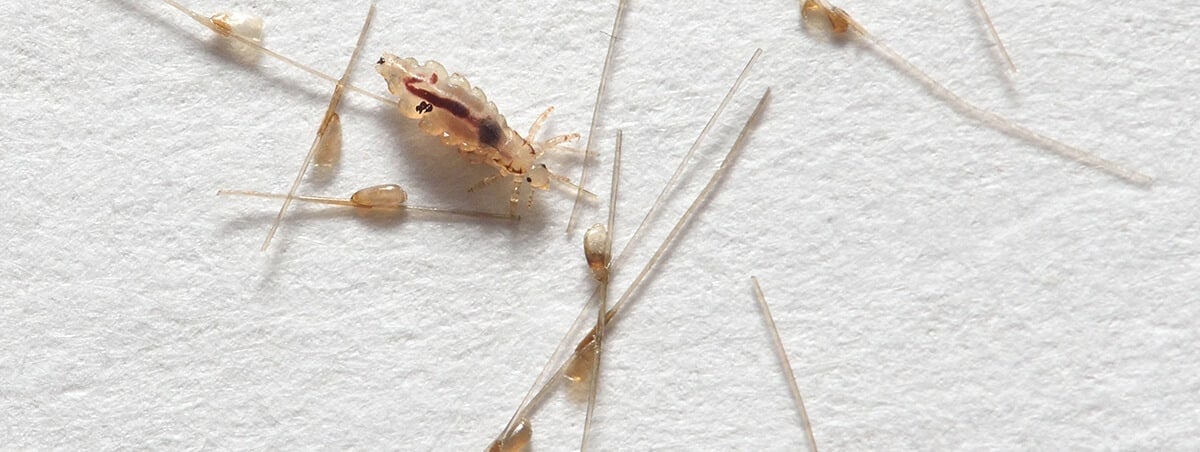 Head Lice 4 Things The School Nurse Won’t Tell You