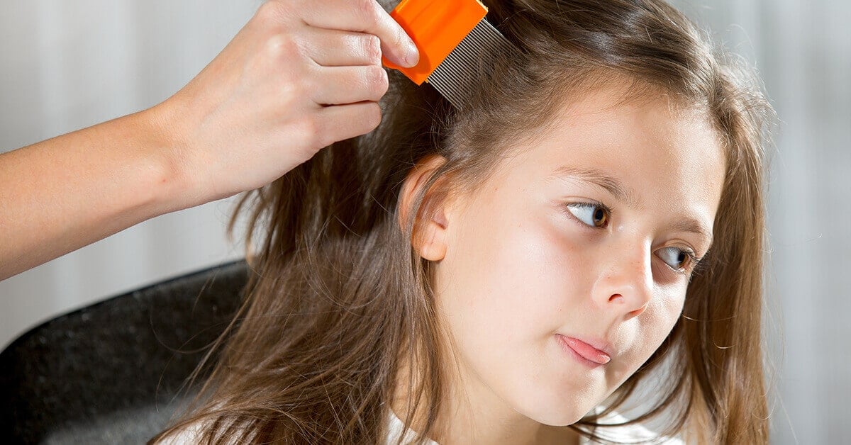 Head Lice 4 Things The School Nurse Won’t Tell You