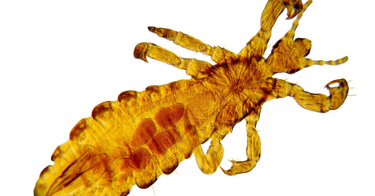 Head Lice 4 Things The School Nurse Won’t Tell You